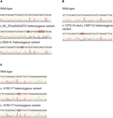NUDT15 Genetic Variants in Chinese Han, Uighur, Kirghiz, and Dai Nationalities